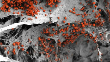 مدل آزمایشگاهی مغز استخوان انسانی